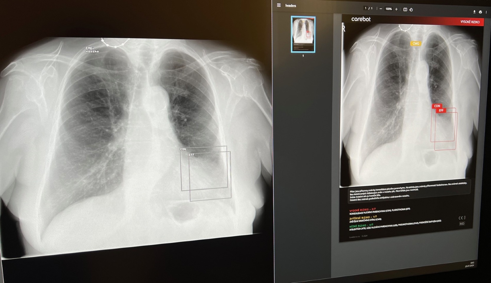 Umělá inteligence přináší revoluční změny do medicíny. V táborské nemocnici nyní testujeme systém CARE BOT